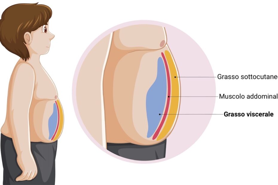 Grasso Viscerale come si elimina